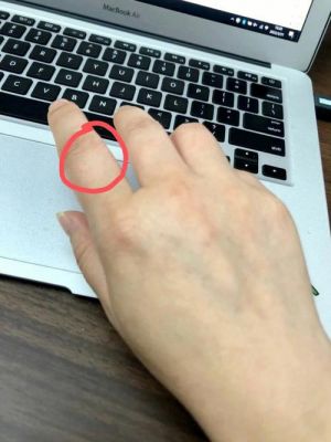 玩电脑时间长食指指疼(电脑玩久了手指关节疼怎么办)-图2 玩电脑时间长食指指疼(电脑玩久了手指关节疼怎么办)-图2