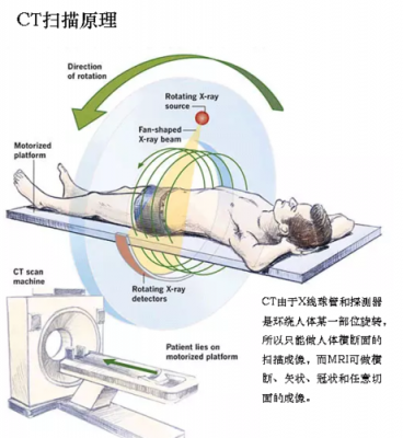 ct诊断人工智能（ct诊断人工智能的原理）